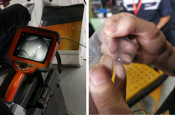 使用韦林内窥镜排除异物的应用案例